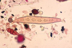 Drechslera helminthosporium
